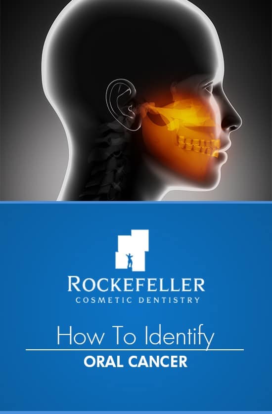 How to Identify Oral Cancer