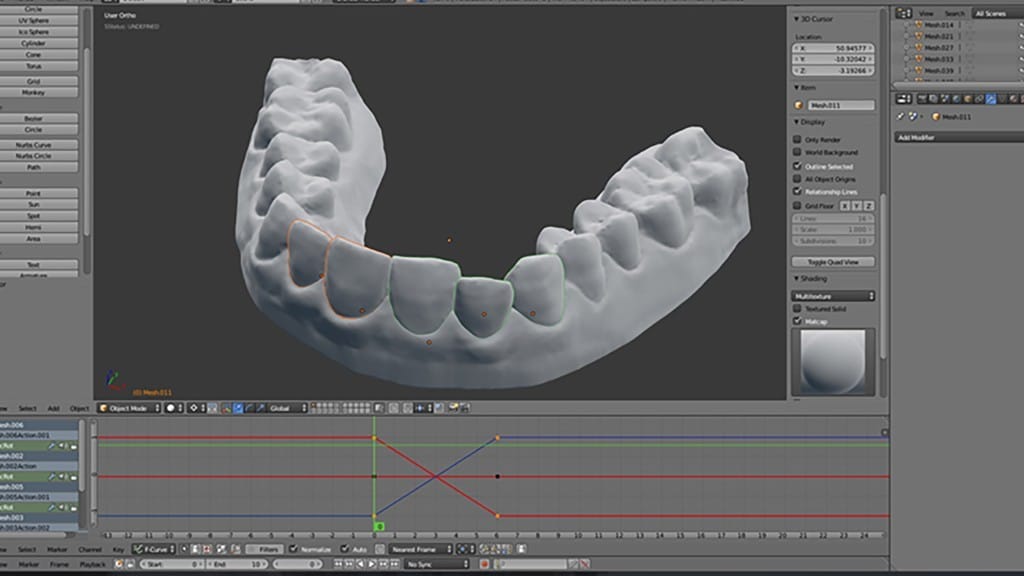 3d Imaging process for Invisalign