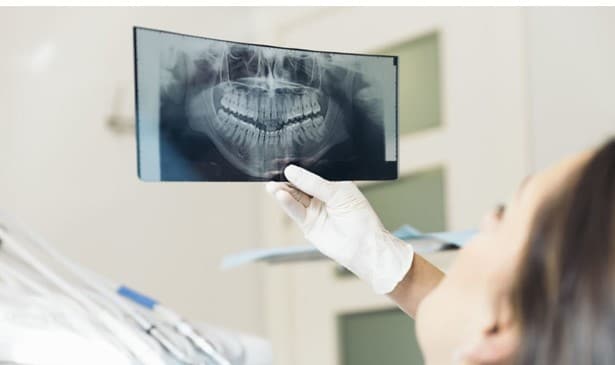 Dental Xray