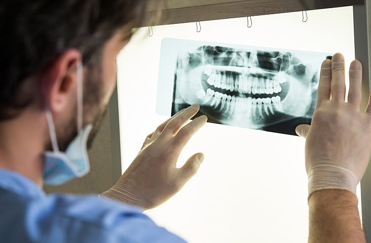 Dental Xray