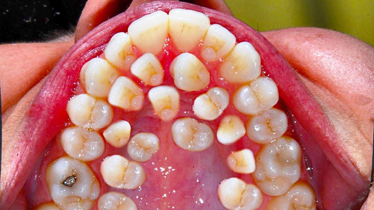 Rare Dental Cases