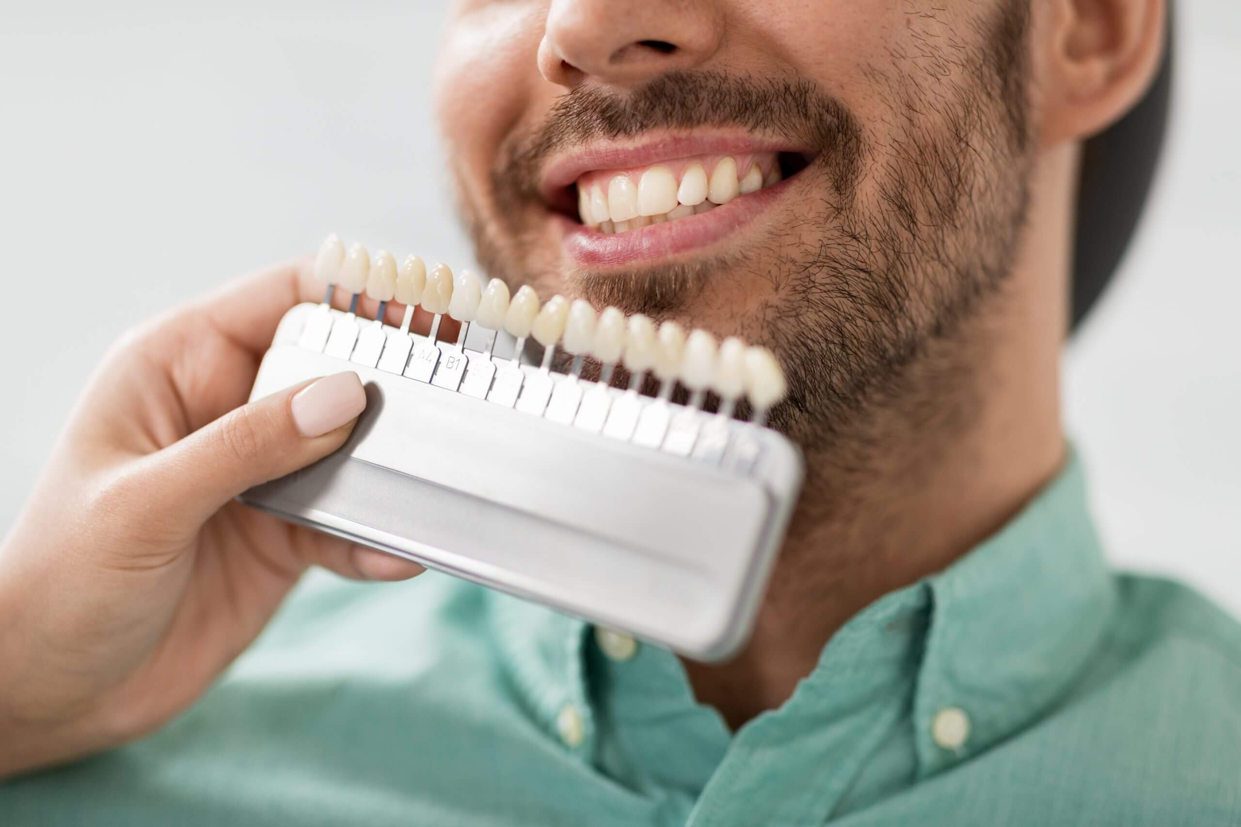 dentist choosing tooth color for patient at clinic