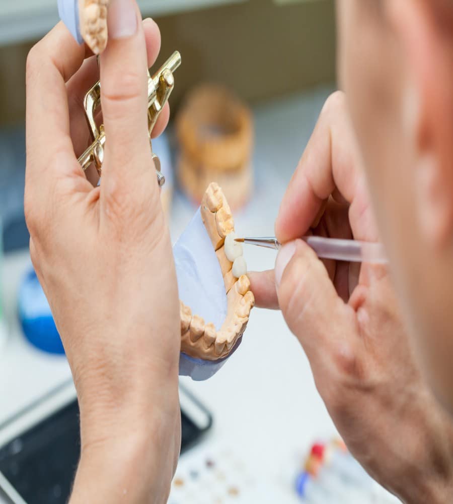 _Advantages Of A Dental Bridge_