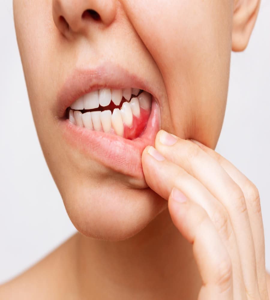 _Signs Of Gum Disease_