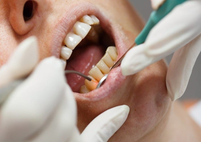 _Uses of Laser Dentistry_