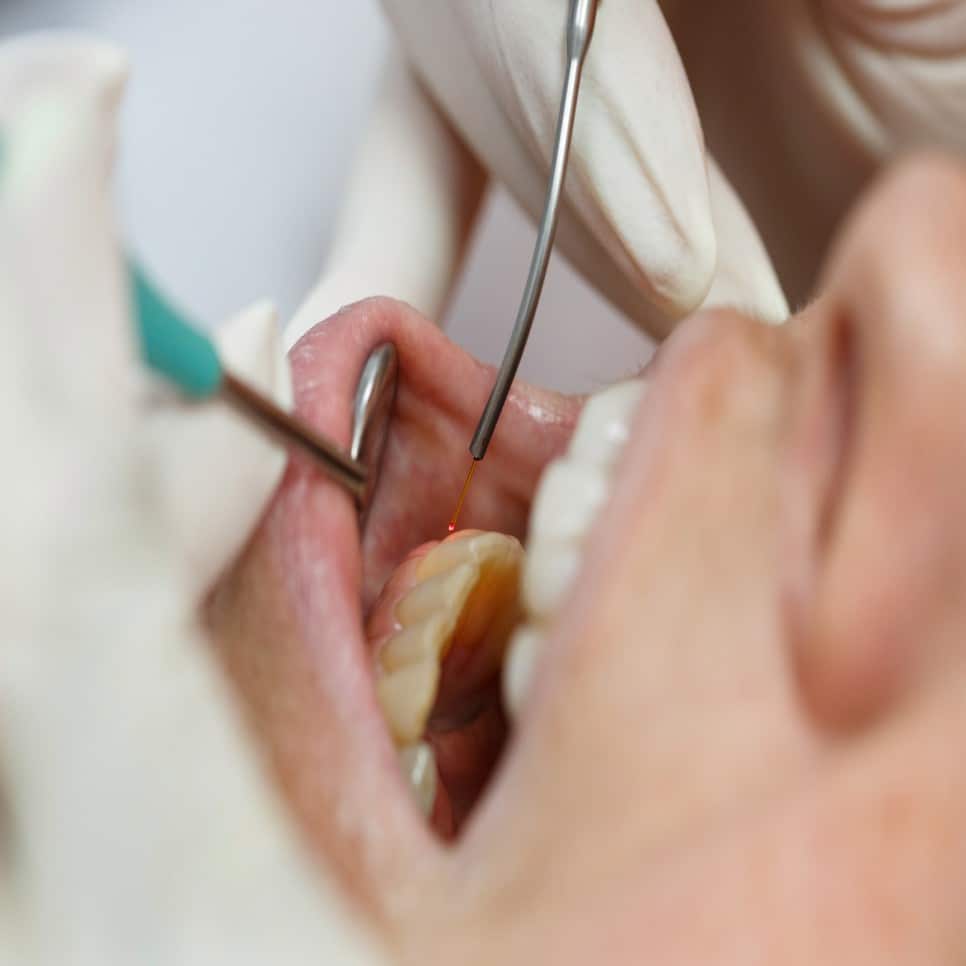 _Laser Dentistry NYC_