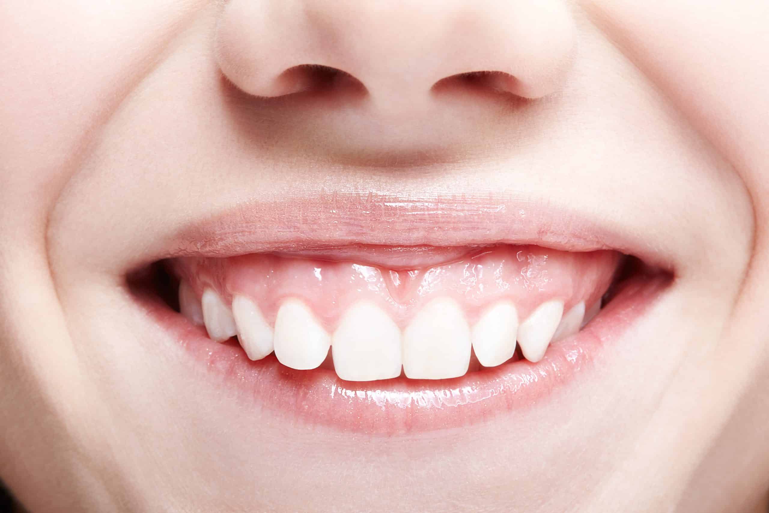 Woman with pink lips and healthy dentes.Girl is smiling.