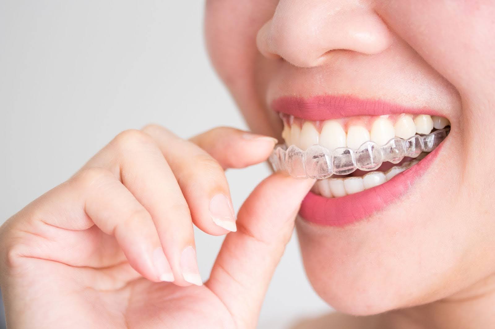 Does Invisalign Hurt? Understanding Discomfort and Pain Management
