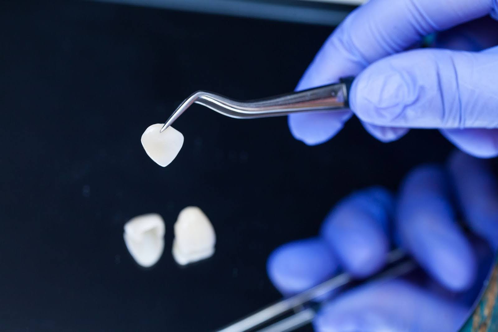 Comprehensive Comparison: Composite vs Porcelain Veneers in Cosmetic Dentistry