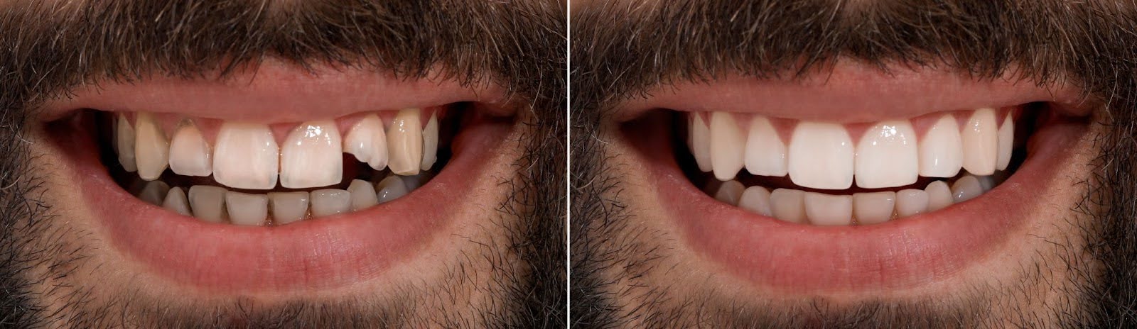 Before and After Transformations