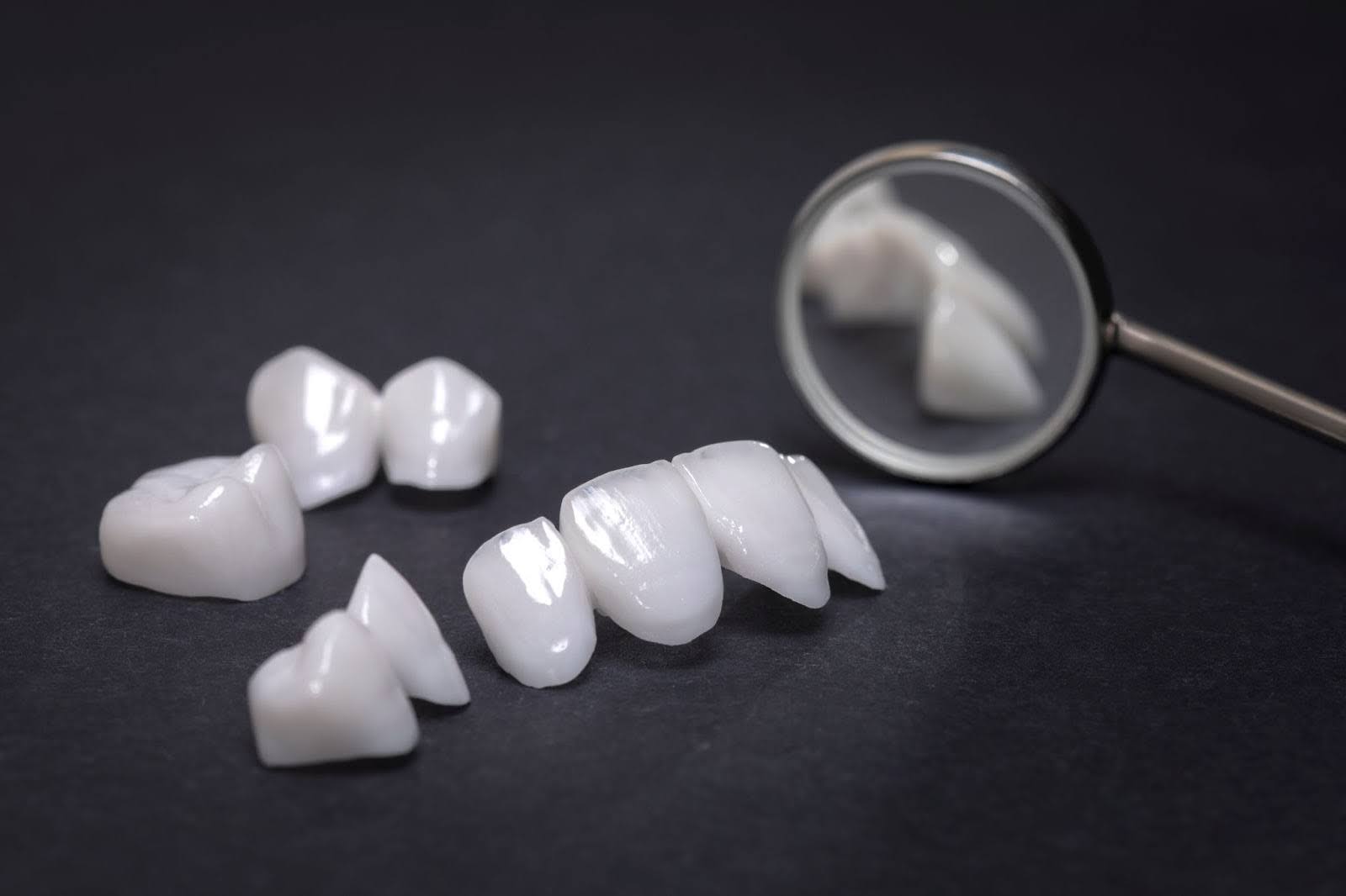 Exploring Durability: How Long Do Porcelain Veneers Last?