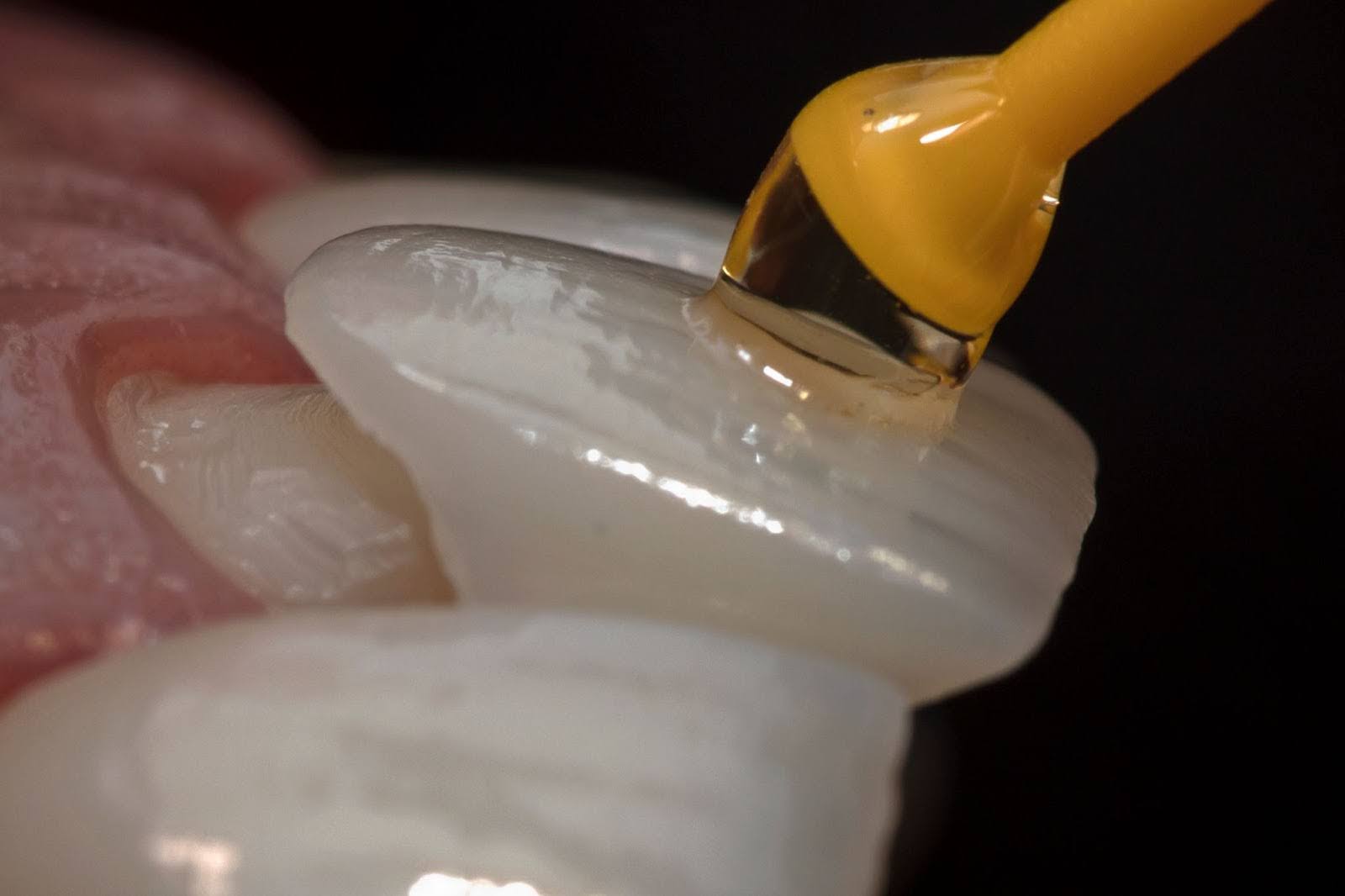 Resin vs Porcelain Veneers: Choosing the Right Option for Your Smile