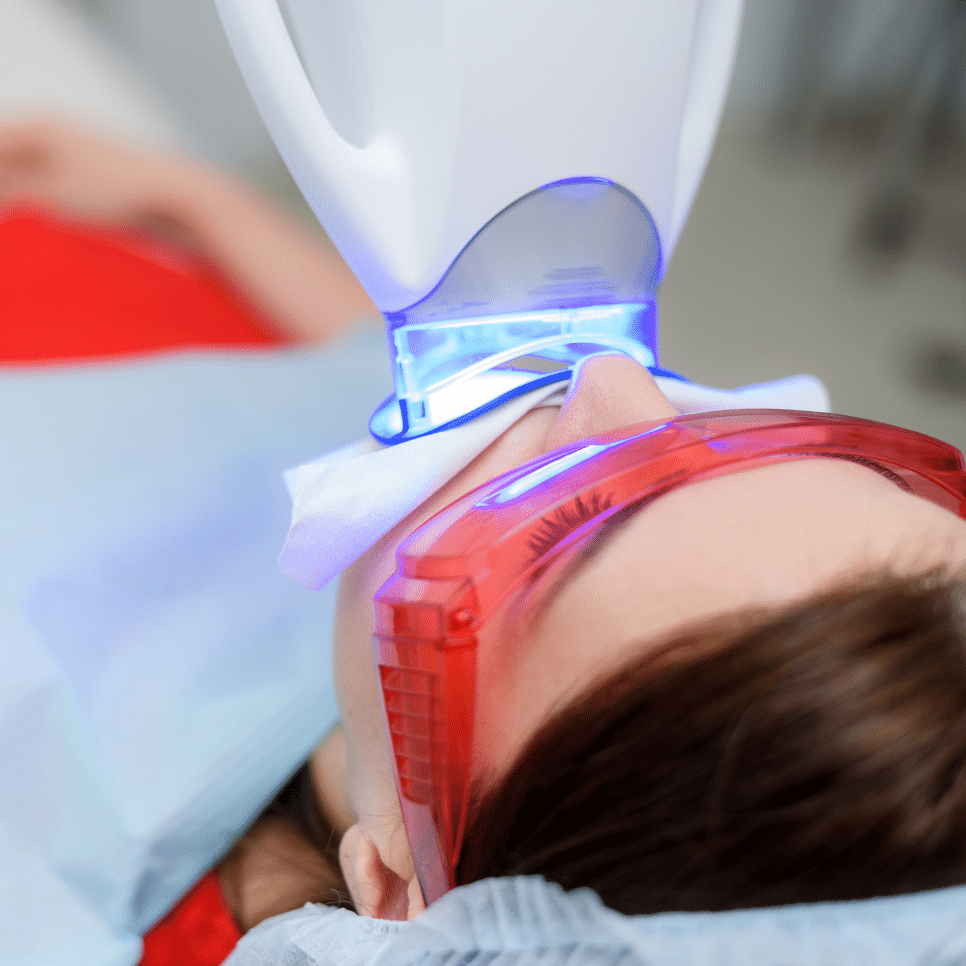 Teeth Whitening Image 2 (966 x 966 px)